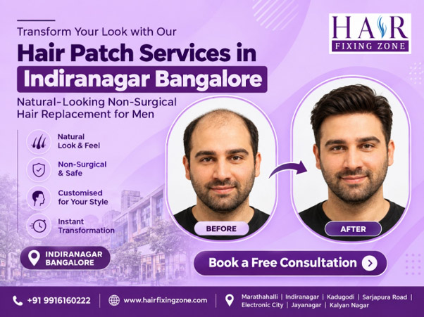 Hair Patch Services in Indiranagar Bangalore