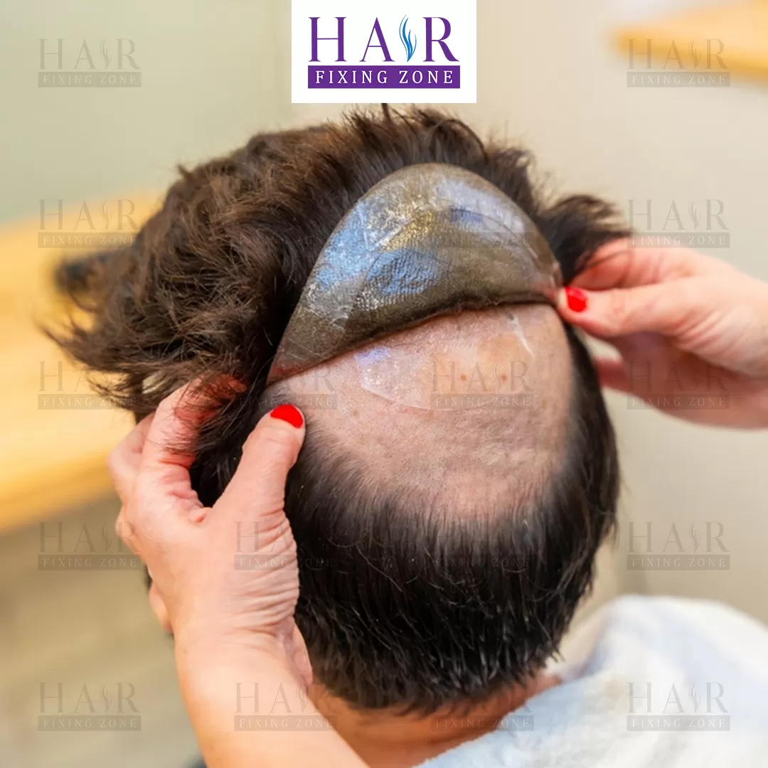 Hair Fixing Zone Bangalore