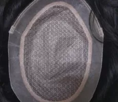 Hair Patches In Sarjapur Rd