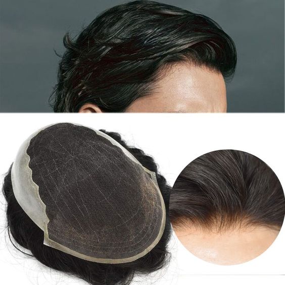 Full lace hair patches in Bengaluru