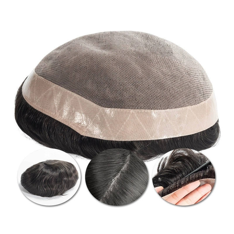 Customized hair patches in Bengaluru