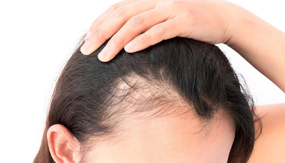 Top Hair Fixing Services in Bangalore | Hair Fixing Zone Top Hair Fixing Services in Bangalore | Hair Fixing Zone